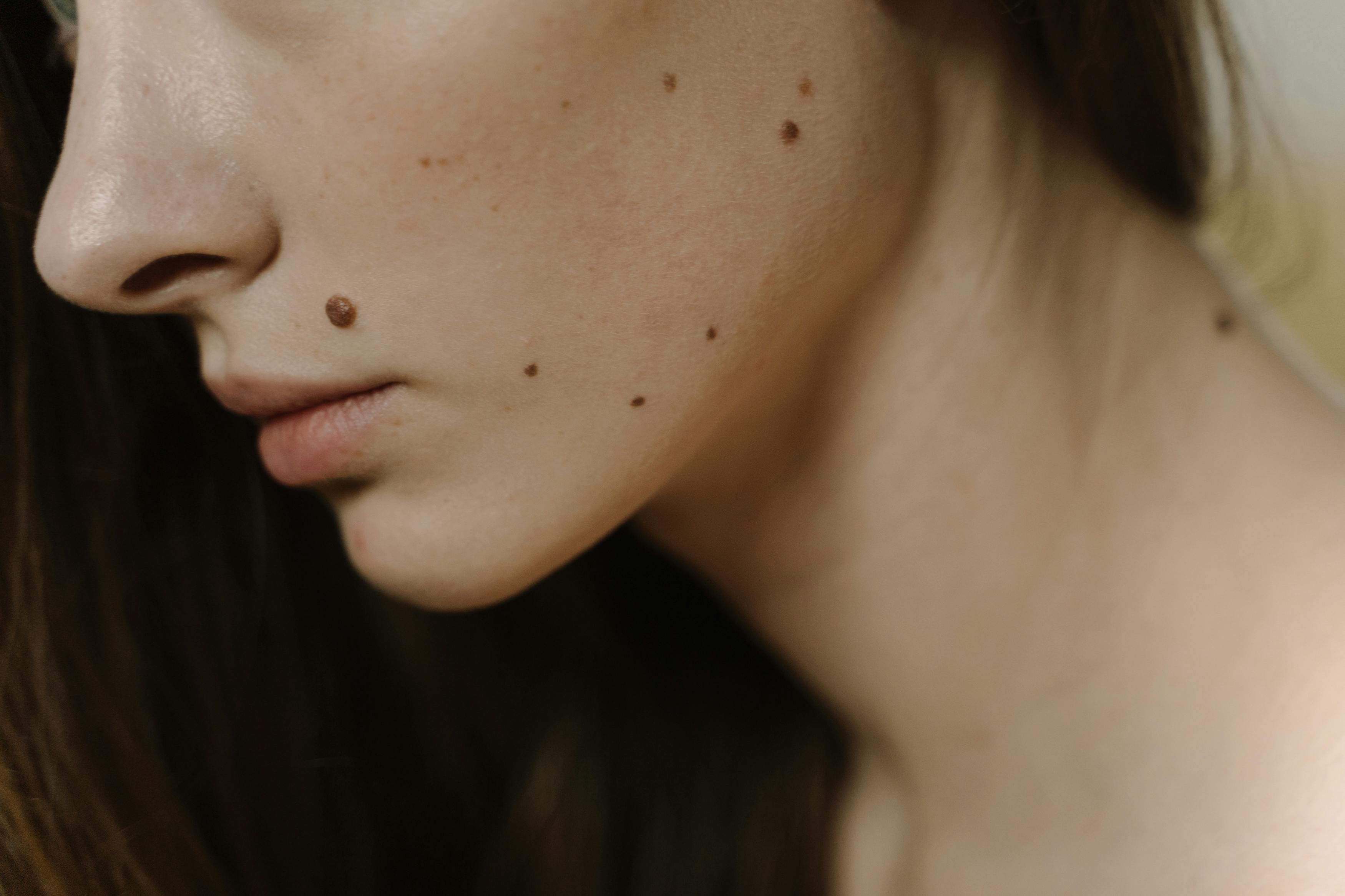 Close-up profile of facial skin and beauty marks