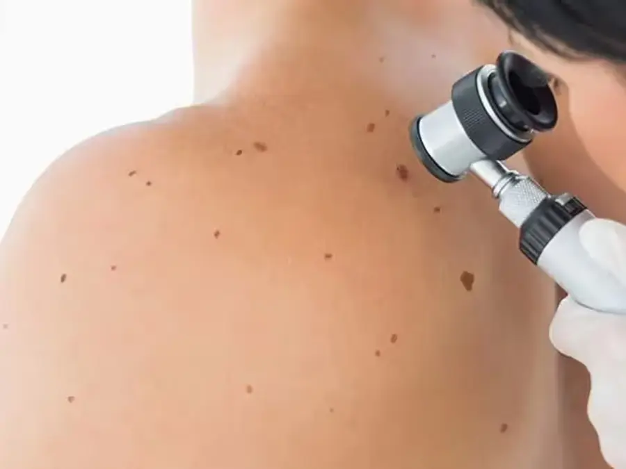 Dermatology hero image